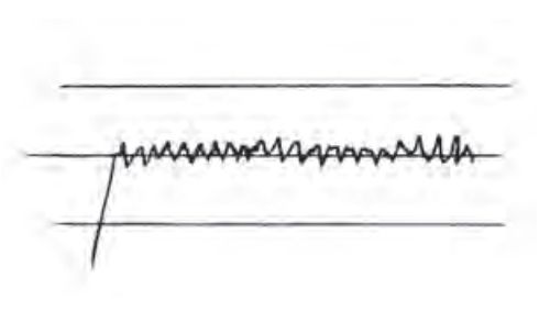 टॉर्क कीपर