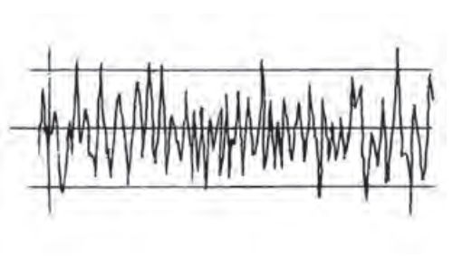 सामान्य ब्रेक